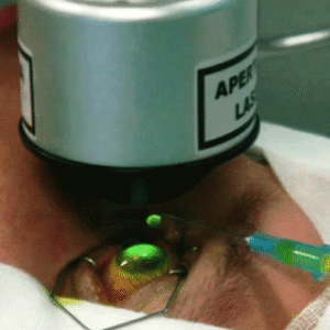 Crosslinking