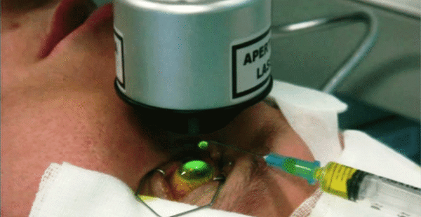 Crosslinking