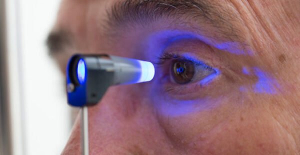 Glaucoma