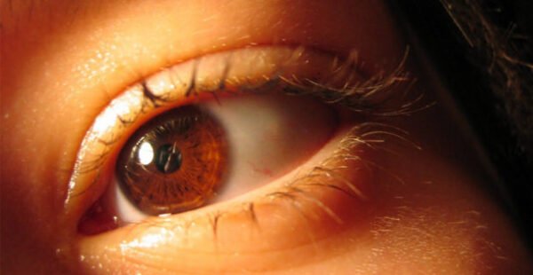 Retinopatia Diabética