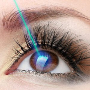 Cirurgia Refrativa (Laser) – LASIK, iLASIK e PRK