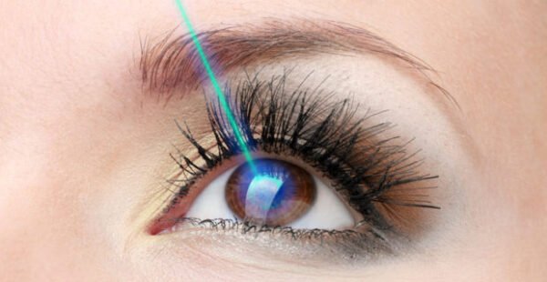 Cirurgia Refrativa (Laser) – LASIK, iLASIK e PRK